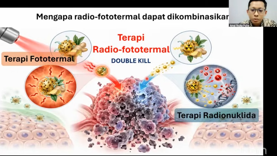 Nanopartikel Berbasis Rimpang Bangle dan Emas Radioaktif untuk Terapi Kanker